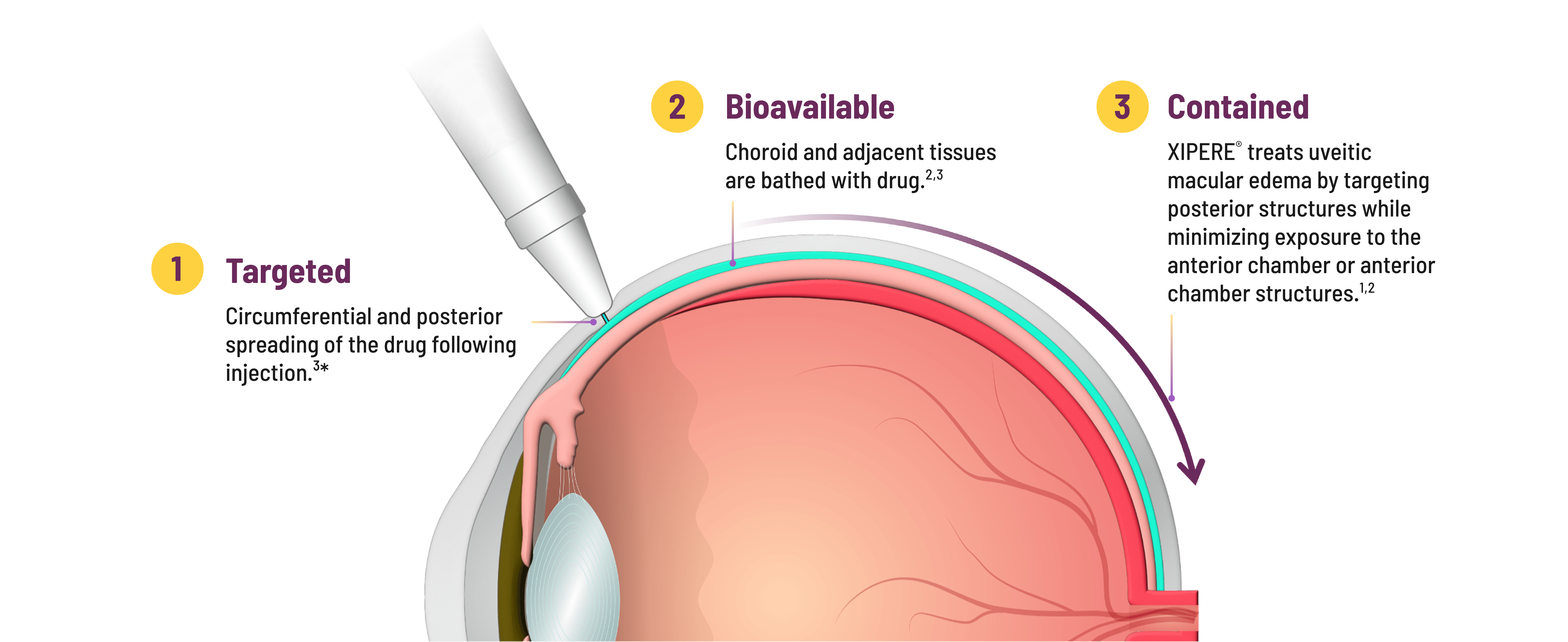 suprachoroidal eye
