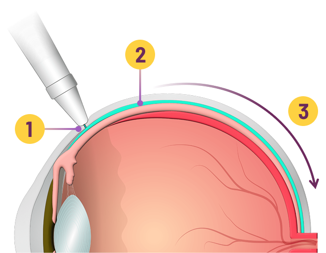 eye mob